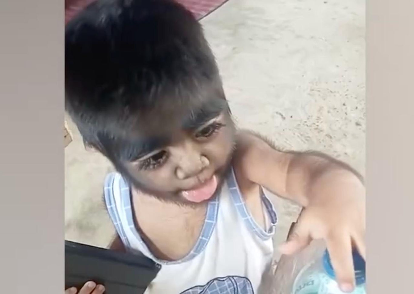 В Испании у маленьких детей начал проявляться «синдром оборотня»